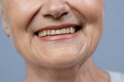 Preventing Gum Disease